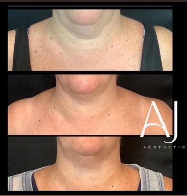 Anne Judge Aesthetics