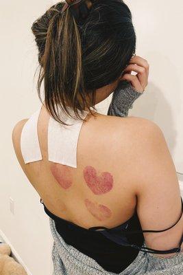 Gia Hoa Pham - Divine Seed Acupuncture