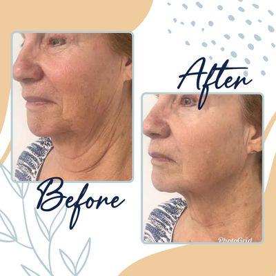 Monroe’s Everlasting Beauty