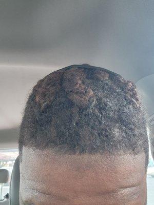 You can see where they cut too much went back from where my hair was