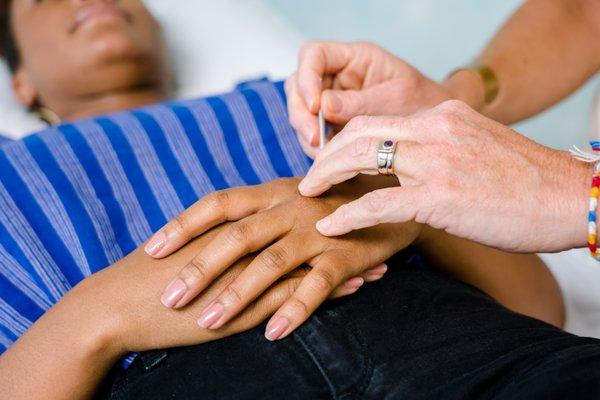 Carmen McIntyre Acupuncture