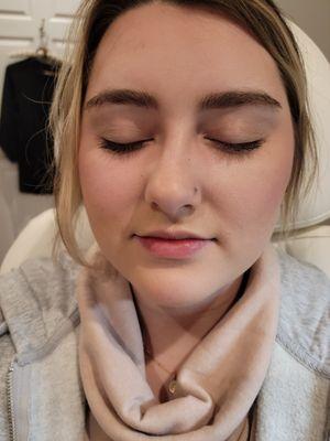 About Face Cosmetic Injectables