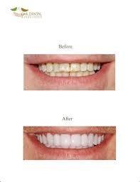 Christopher Pallotto , DDS