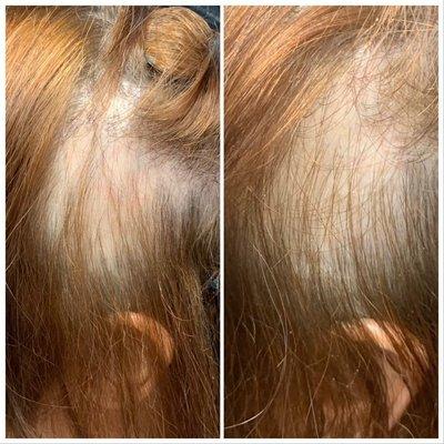 ReGrowIt All Natural Blend of Essential Oils