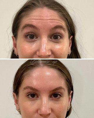 Bare Skin Medical Spa