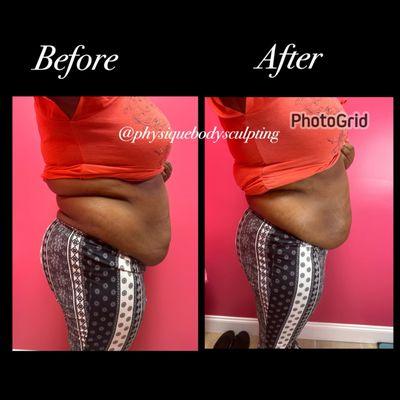 My clients 1st results look amazing
She lost 2 inches her first session
