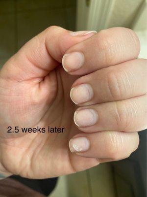 2.5 weeks afterwards, you can begin to see the grow out and how much the nail grinder took off my nails.
