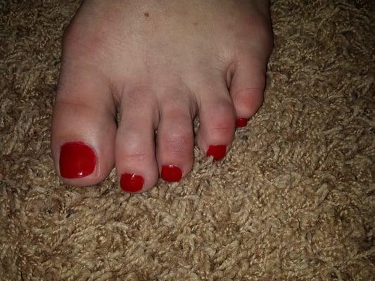Post pedicure