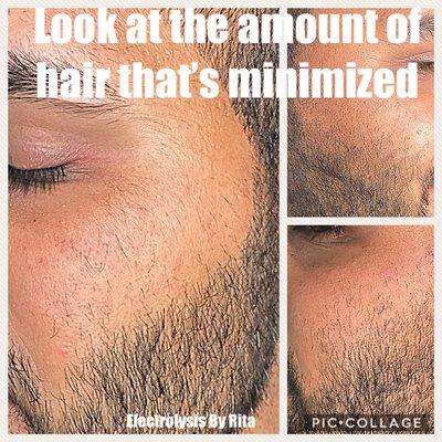 Electrolysis & Skincare By Rita At One Salon