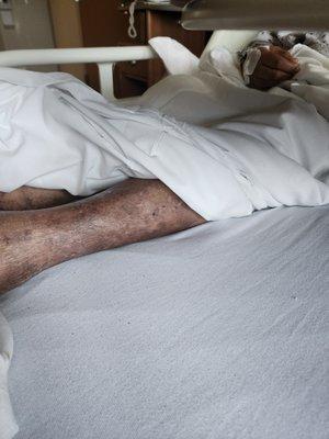 Hamilton Continuing Care Center