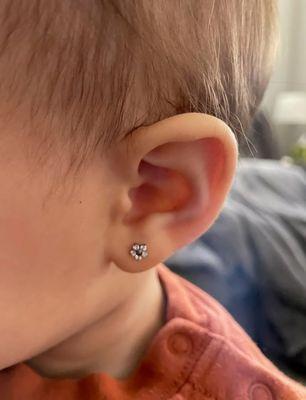 Infant/baby ear lobe needle piercing healed