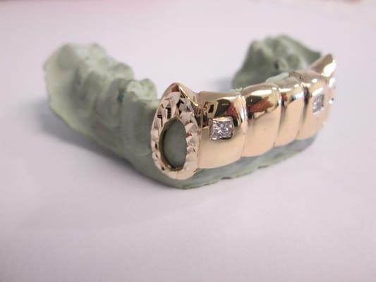 San Diego Gold Grillz