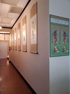 Traditional Chinese Cupping Acupuncture Points