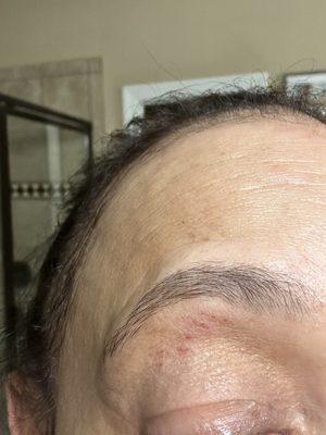 This is what my brow looks like after yesterday's threading