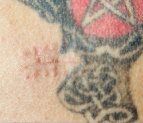 Alaska Center For Dermatology