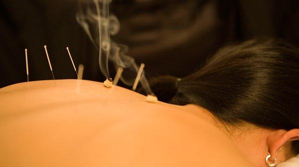 Newport Medical Acupuncture Health Center