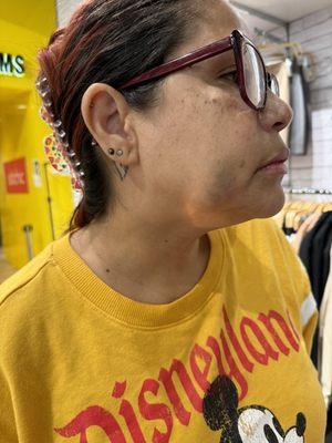 Another view of my face. The pain they caused