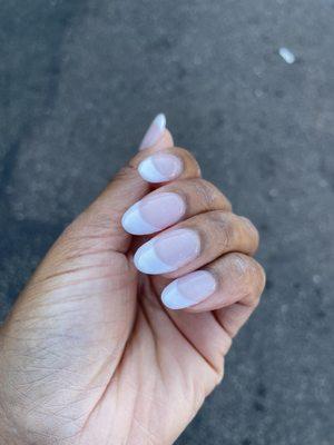 The shape of the pinky is not almond shaped, none of them are really.