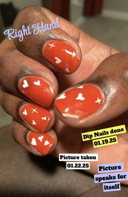 Dip nails on right hand 3 days after service.