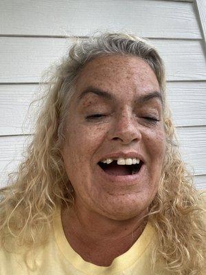 After $30k of work! Just horrible