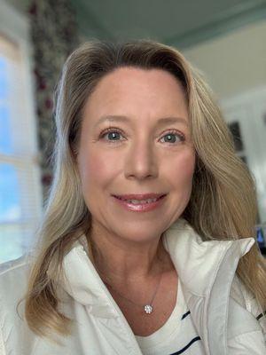 August 31, almost 5 months post op.