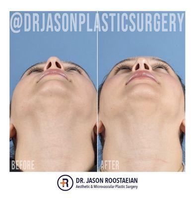 Jason Roostaeian, MD