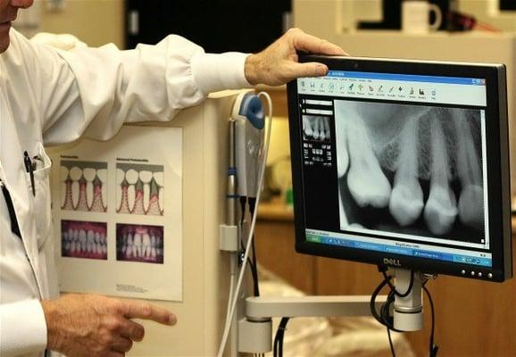Digital Dental X-rays