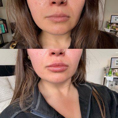 before / immediately after