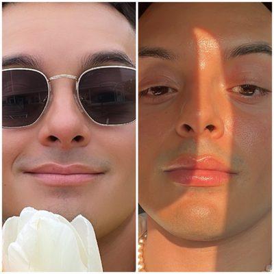 Before and after