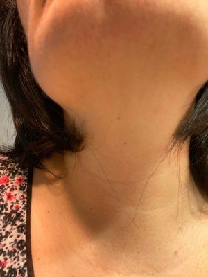 Flyaways on both sides