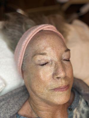 Glass skin is always in