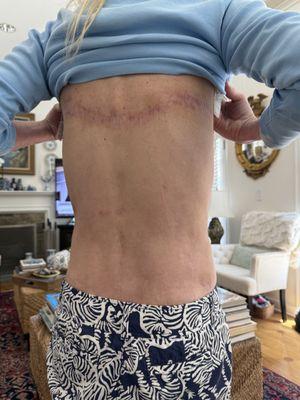 Franklin D. Richards, M.D., F.A.C.S.