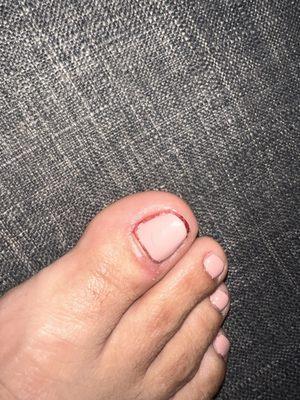 Mala experiencia tuve el día d hoy la chica Anapaula me hizo pedicura y me lastimó muy feo mi uña me sangró mi uña