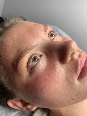 NeoDerm Aesthetics