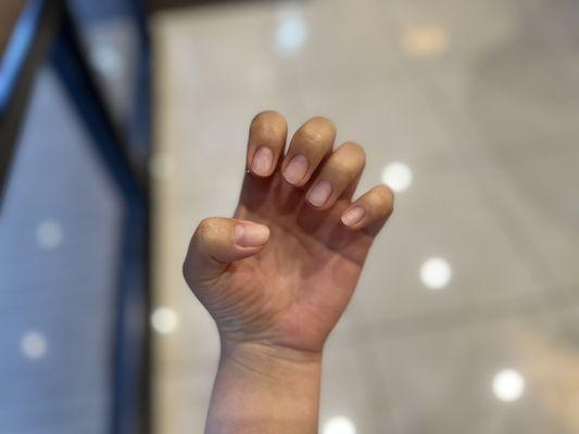 after gel nail removal