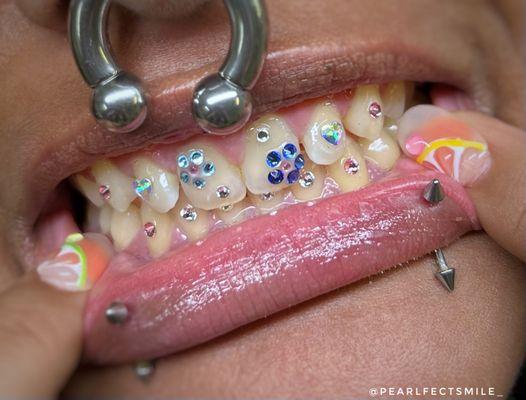 Freestyle Tooth Gem Set