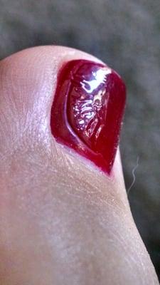 Terrible pedicure. What is in this nail polish?