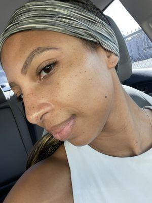 Minimalist facial results