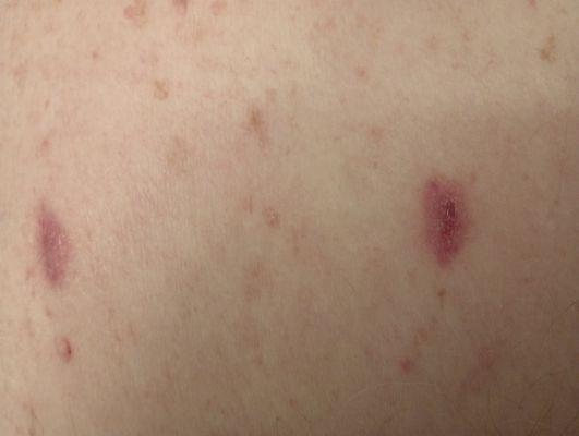 Moon Charles Dermatologist