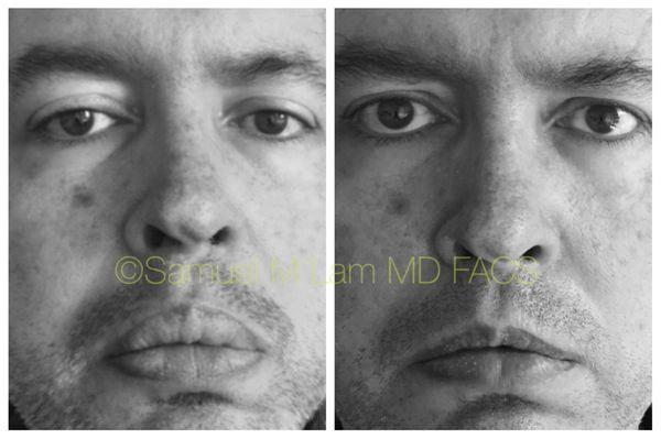 Lam Institute for Hair Restoration