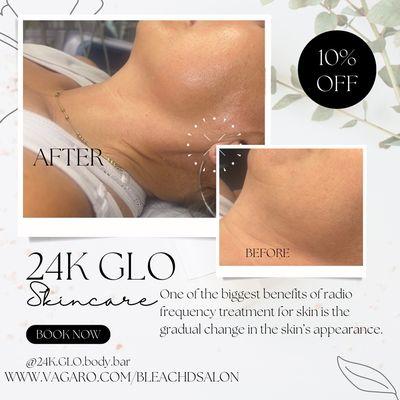 Rf Facial(minimize fine lines)