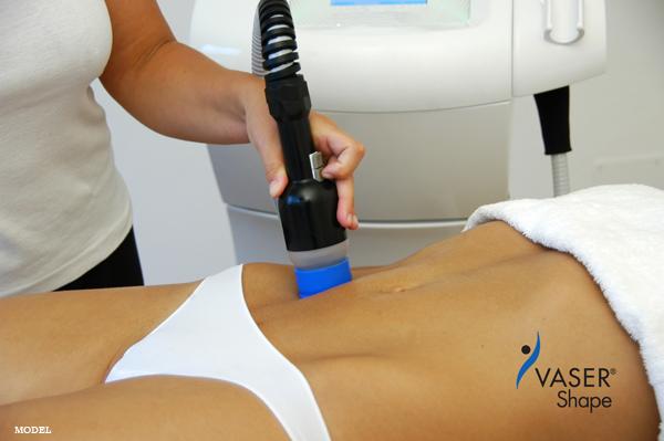 VASERShape Treatment