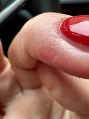 The owners assaulting me