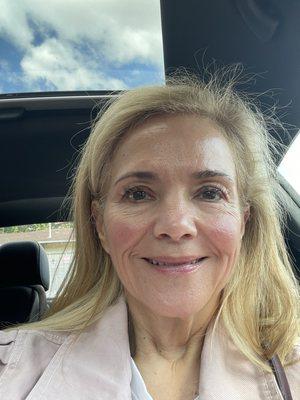 Post Hydra Facial- truly glowing!