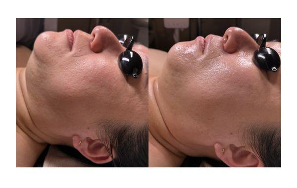 Glow Skin Therapy K-Beauty Facials