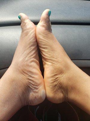 For comparison: Left foot - immediately after leaving, Right foot - after I added lotion in my car