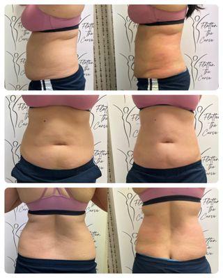 Flatten the Curve Body Sculpting