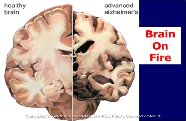 Renovare Wellness By Design