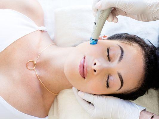 Hydrafacial exfoliates, extracts and hydrates, dislodges and removes impurities while hydrating skin with potent antioxidant solutions.