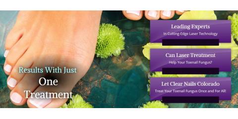 Clear Nails Colorado